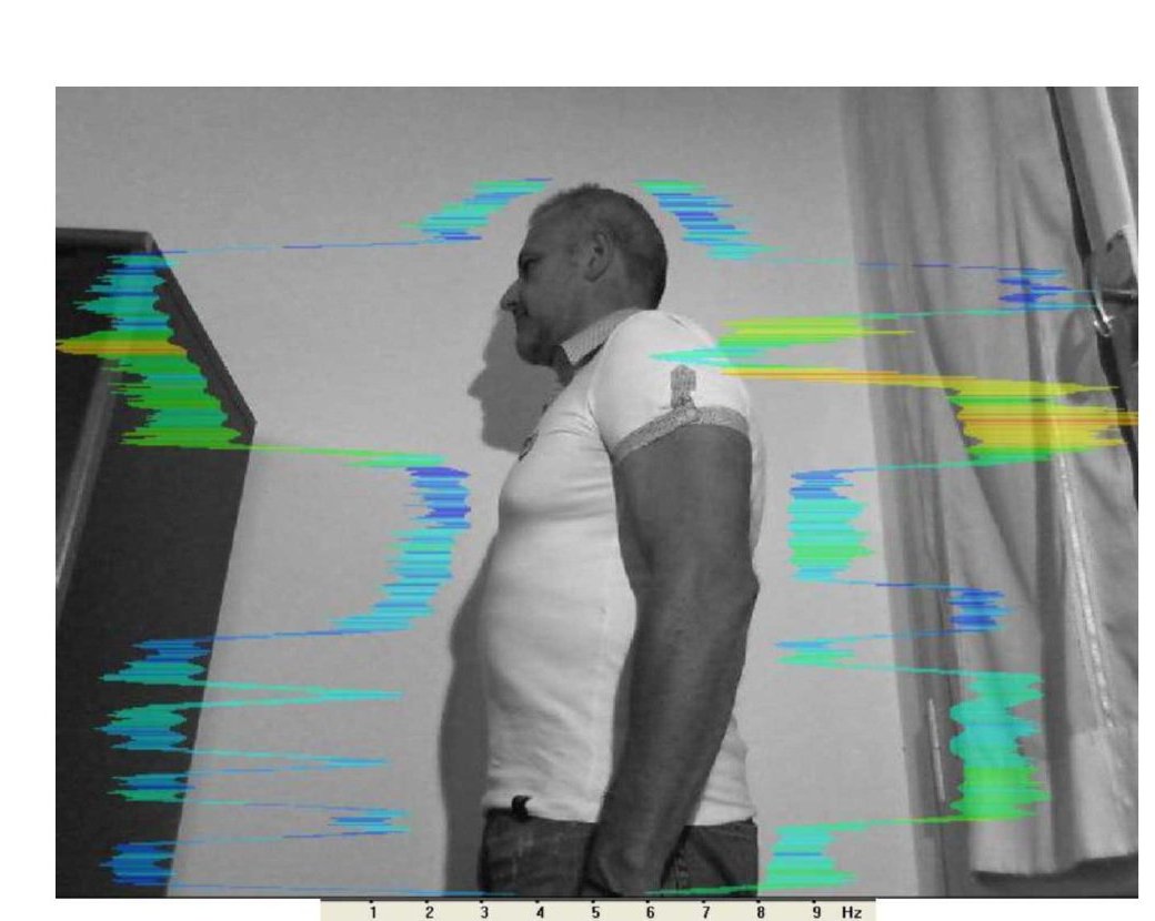 Vibrational energy field before session — side profile, yellow-green congestion at left shoulder
