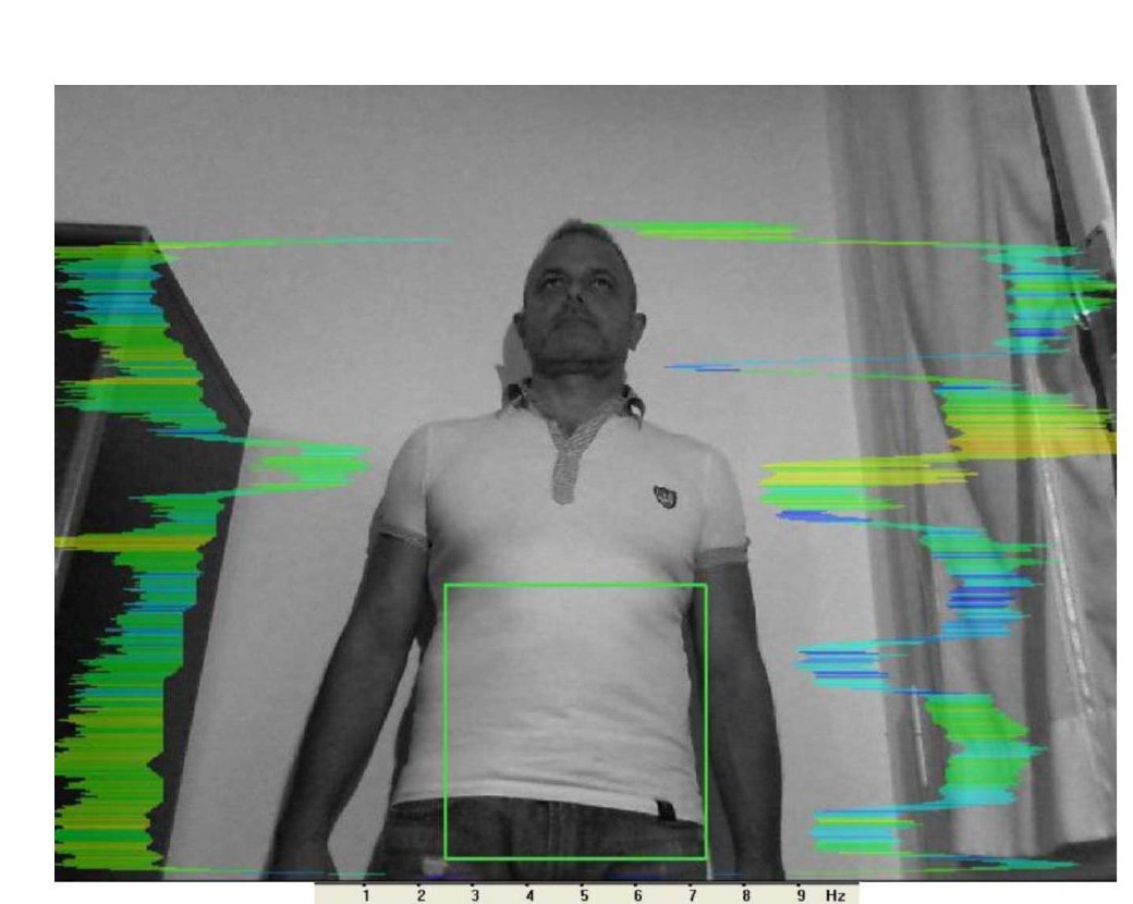 Vibrational energy field before session — frontal, blockage at left shoulder