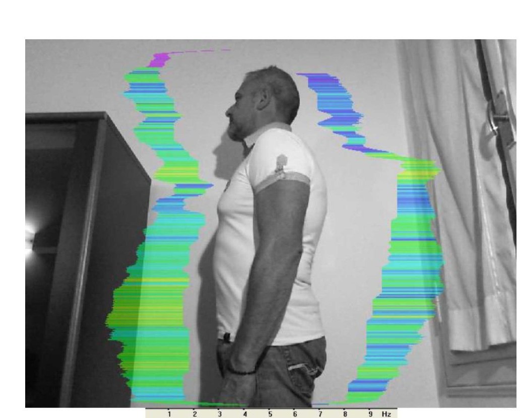 Vibrational energy field after session — side profile, coherent blue-green field close to body