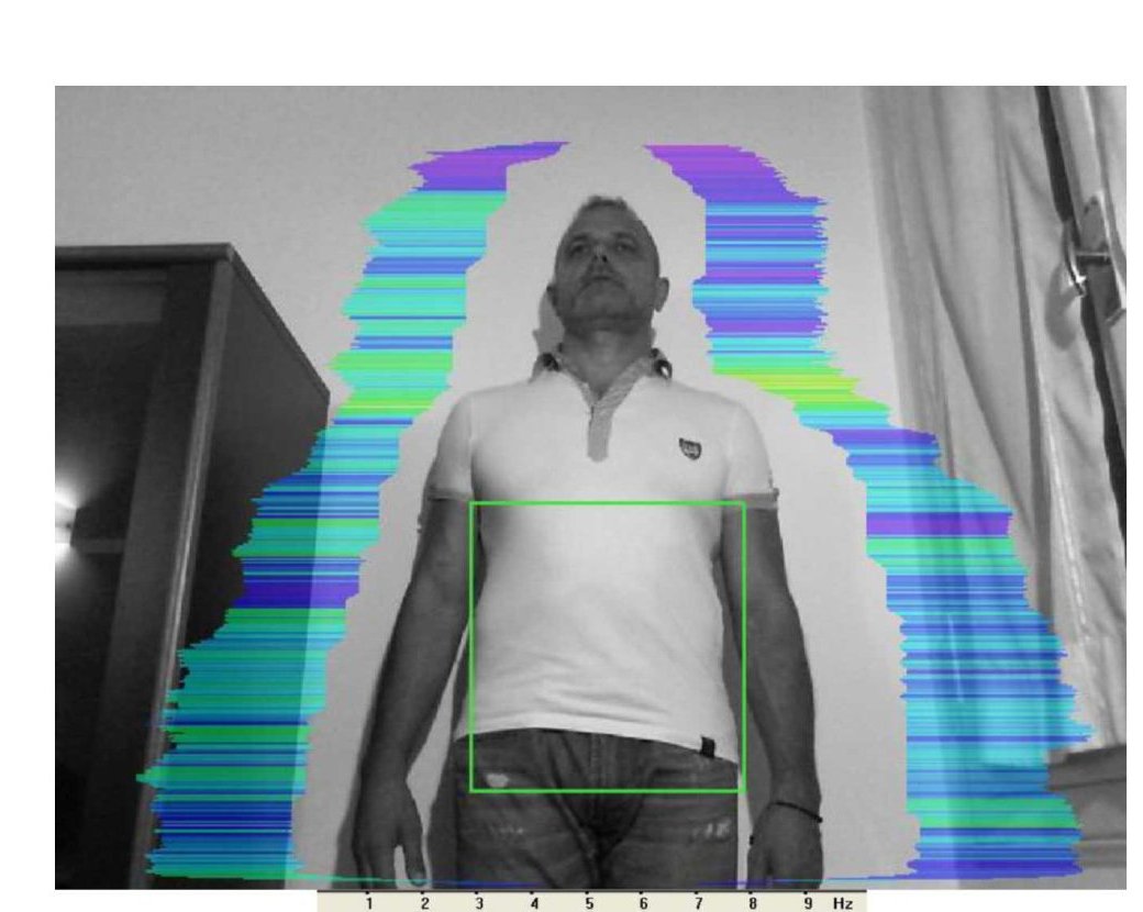 Vibrational energy field after session — frontal, blue-violet relaxation field around head