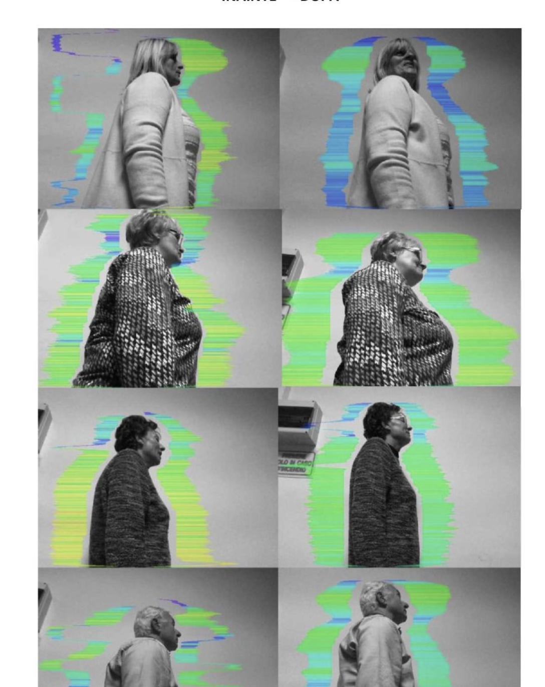 Grid of 8 before and after vibrational field measurements from 4 different subjects at Chivasso